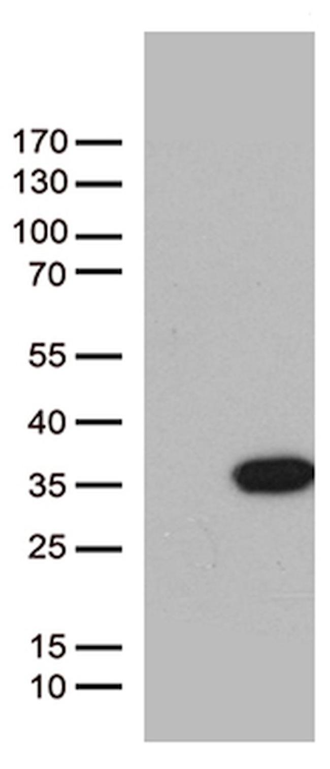 BCL2L11 Antibody in Western Blot (WB)
