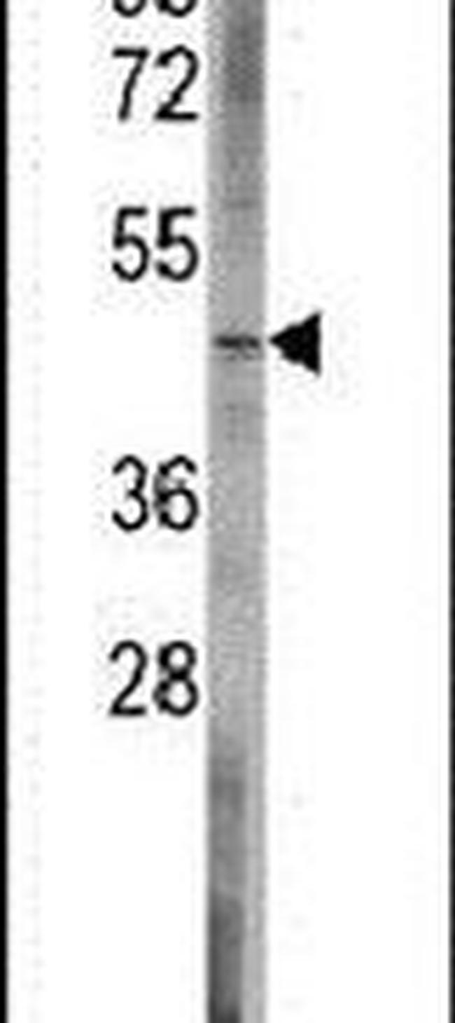 Bcl-rambo Antibody in Western Blot (WB)