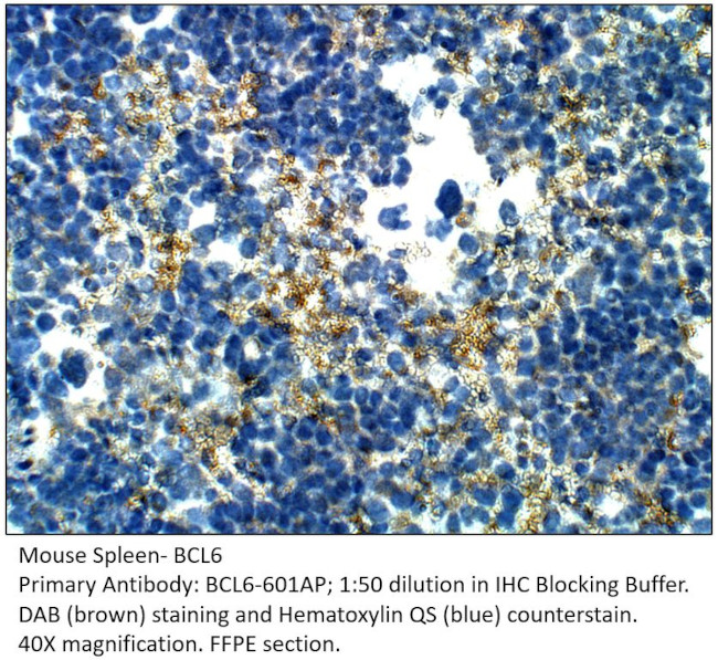 Bcl6 Antibody in Immunohistochemistry (IHC)