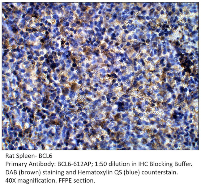 Bcl6 Antibody in Immunohistochemistry (IHC)