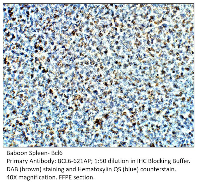 Bcl6 Antibody in Immunohistochemistry (IHC)