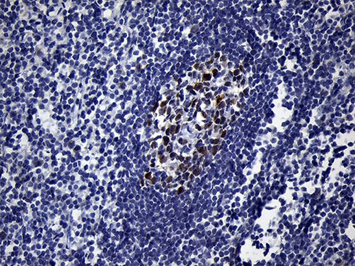 BCL6 Antibody in Immunohistochemistry (Paraffin) (IHC (P))