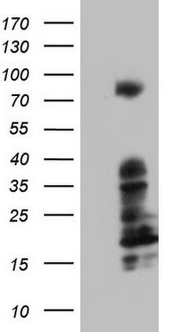 BCL6 Antibody in Western Blot (WB)