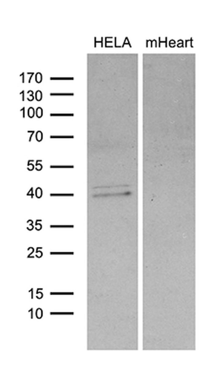 BCL7B Antibody in Western Blot (WB)
