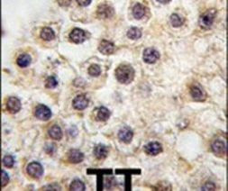 BDP Antibody in Immunohistochemistry (IHC)