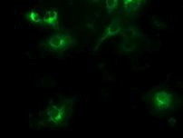 BECN1 Antibody in Immunocytochemistry (ICC/IF)