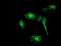 BECN1 Antibody in Immunocytochemistry (ICC/IF)