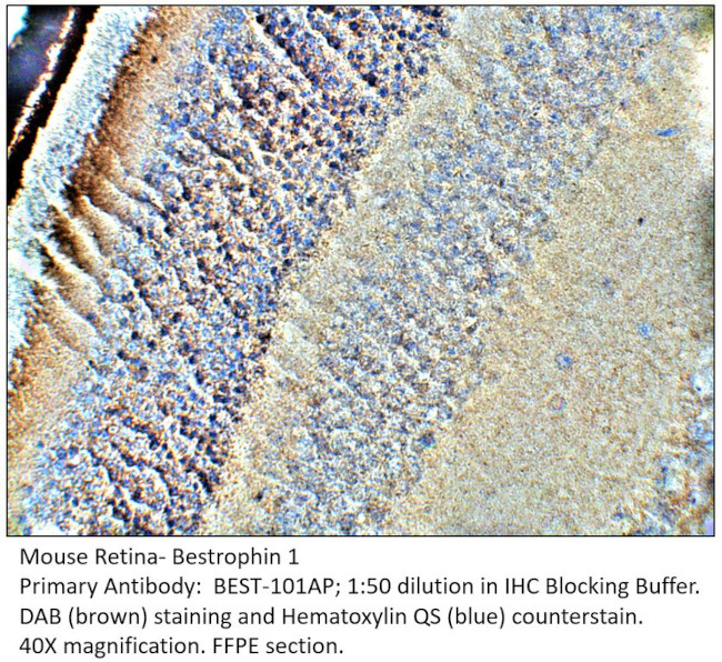 Bestrophin Antibody in Immunohistochemistry (IHC)