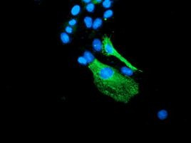 BEST3 Antibody in Immunocytochemistry (ICC/IF)
