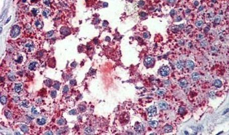 BEST3 Antibody in Immunohistochemistry (Paraffin) (IHC (P))