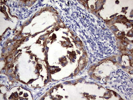 BFSP1 Antibody in Immunohistochemistry (Paraffin) (IHC (P))