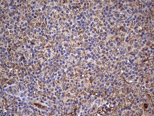 BFSP1 Antibody in Immunohistochemistry (Paraffin) (IHC (P))