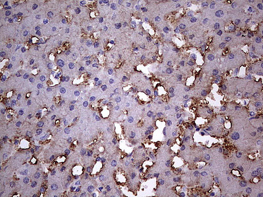 BFSP1 Antibody in Immunohistochemistry (Paraffin) (IHC (P))
