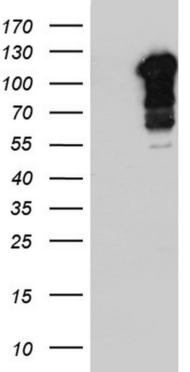 BFSP1 Antibody in Western Blot (WB)