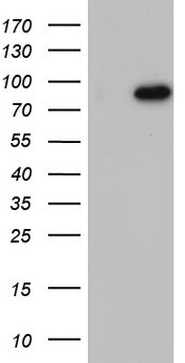 BFSP1 Antibody in Western Blot (WB)