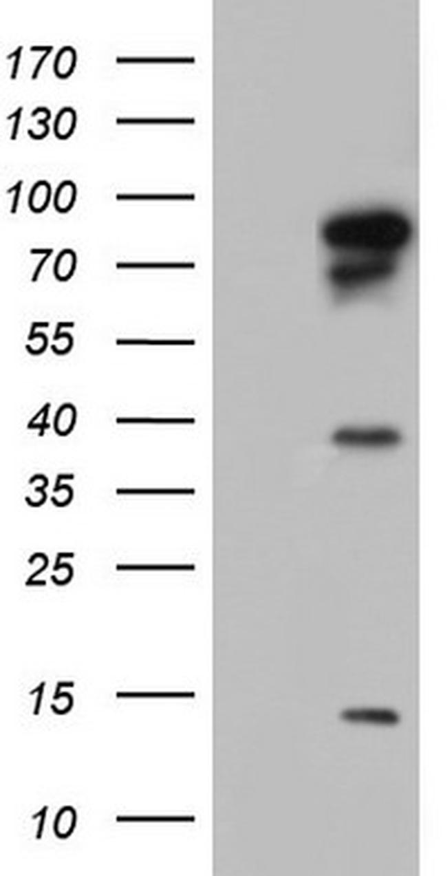 BFSP1 Antibody in Western Blot (WB)