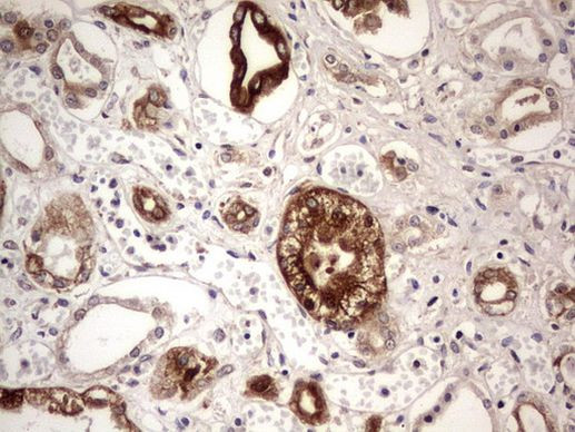 BFSP2 Antibody in Immunohistochemistry (Paraffin) (IHC (P))