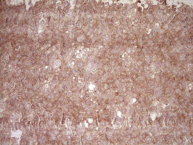 BHLHE41 Antibody in Immunohistochemistry (Paraffin) (IHC (P))