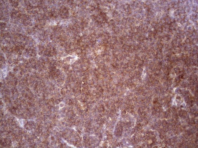 BHLHE41 Antibody in Immunohistochemistry (Paraffin) (IHC (P))