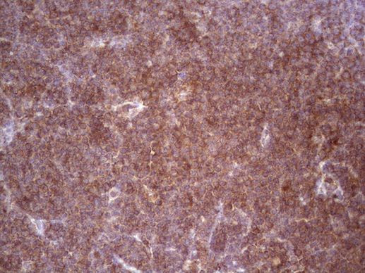 BHLHE41 Antibody in Immunohistochemistry (Paraffin) (IHC (P))