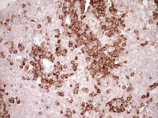 BHLHE41 Antibody in Immunohistochemistry (Paraffin) (IHC (P))