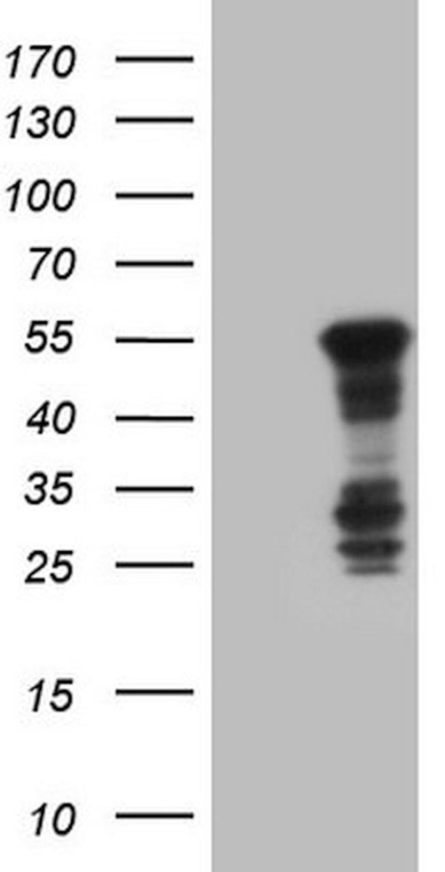 BHLHE41 Antibody in Western Blot (WB)