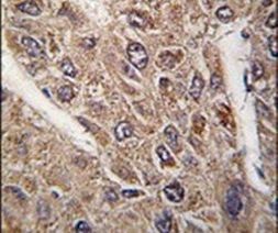 BICD2 Antibody in Immunohistochemistry (IHC)