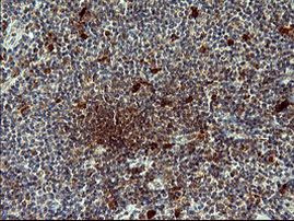 BID Antibody in Immunohistochemistry (Paraffin) (IHC (P))