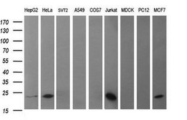 BID Antibody in Western Blot (WB)