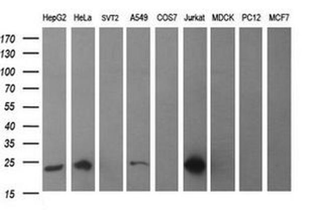 BID Antibody in Western Blot (WB)