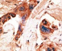BIKE Antibody in Immunohistochemistry (IHC)