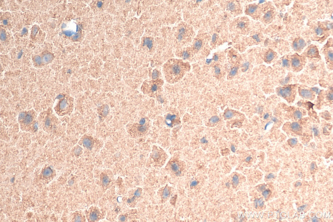 tPA Antibody in Immunohistochemistry (Paraffin) (IHC (P))
