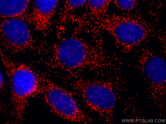 PEX14 Antibody in Immunocytochemistry (ICC/IF)