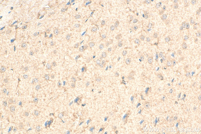 EPHX2 Antibody in Immunohistochemistry (Paraffin) (IHC (P))
