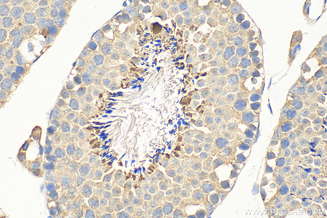 IL-13RA2 Antibody in Immunohistochemistry (Paraffin) (IHC (P))