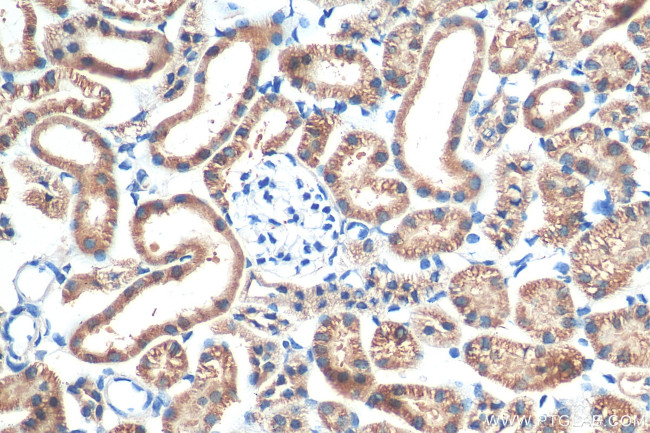 PARK7/DJ-1 Antibody in Immunohistochemistry (Paraffin) (IHC (P))