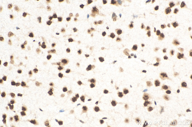 TDP-43 Antibody in Immunohistochemistry (Paraffin) (IHC (P))