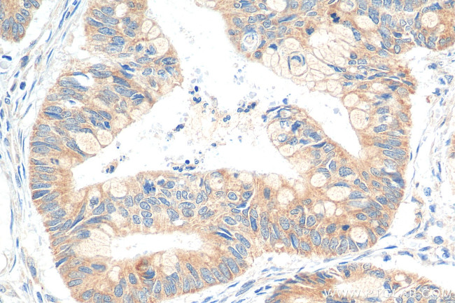 DNAJB12 Antibody in Immunohistochemistry (Paraffin) (IHC (P))