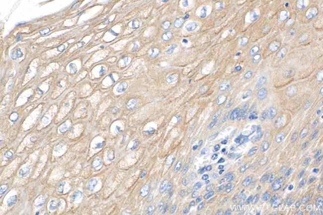 KRT80 Antibody in Immunohistochemistry (Paraffin) (IHC (P))