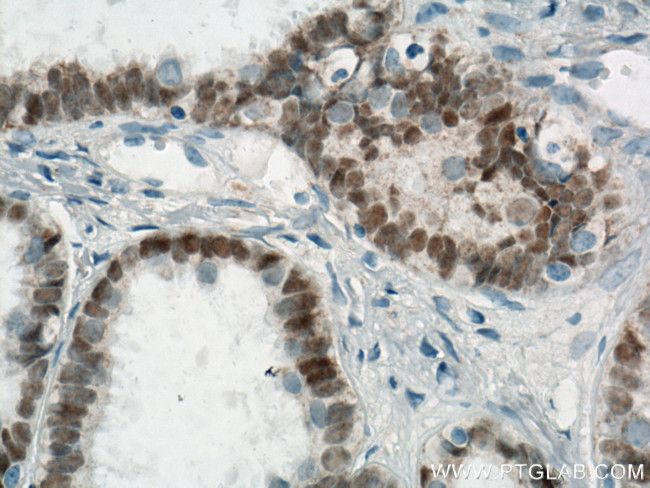 PAX8 Antibody in Immunohistochemistry (Paraffin) (IHC (P))