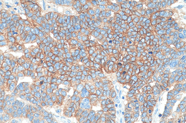 CD9 Antibody in Immunohistochemistry (Paraffin) (IHC (P))