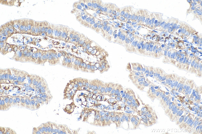 APOA4 Antibody in Immunohistochemistry (Paraffin) (IHC (P))
