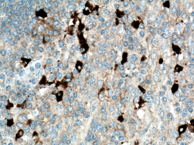 Human IgG4 Antibody in Immunohistochemistry (Paraffin) (IHC (P))