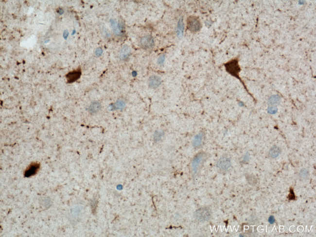 Calretinin Antibody in Immunohistochemistry (Paraffin) (IHC (P))
