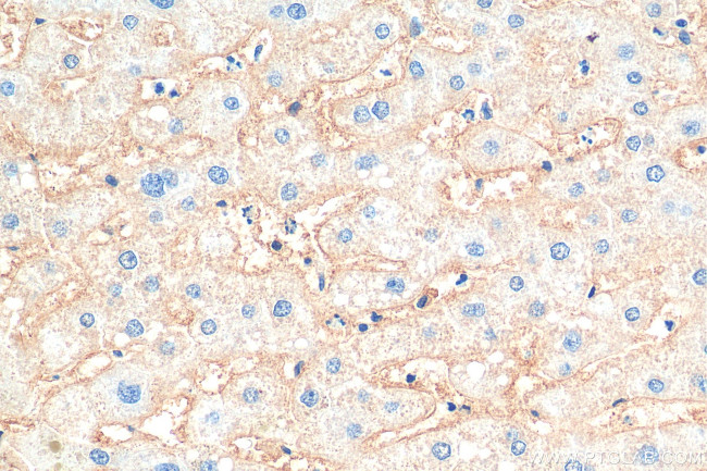 CD81 Antibody in Immunohistochemistry (Paraffin) (IHC (P))