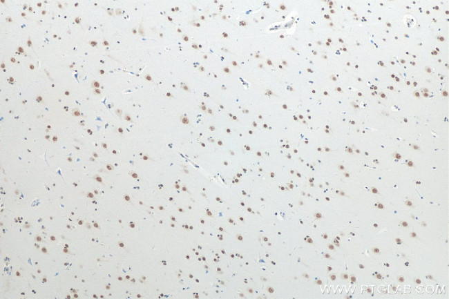 TDP-43 Antibody in Immunohistochemistry (Paraffin) (IHC (P))