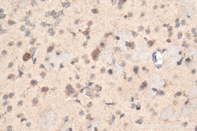 NPTX1 Antibody in Immunohistochemistry (Paraffin) (IHC (P))