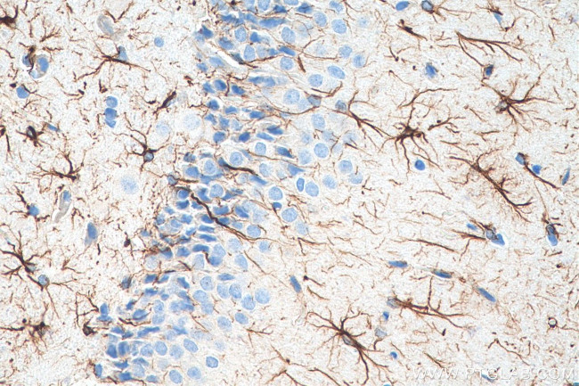 GFAP Antibody in Immunohistochemistry (Paraffin) (IHC (P))
