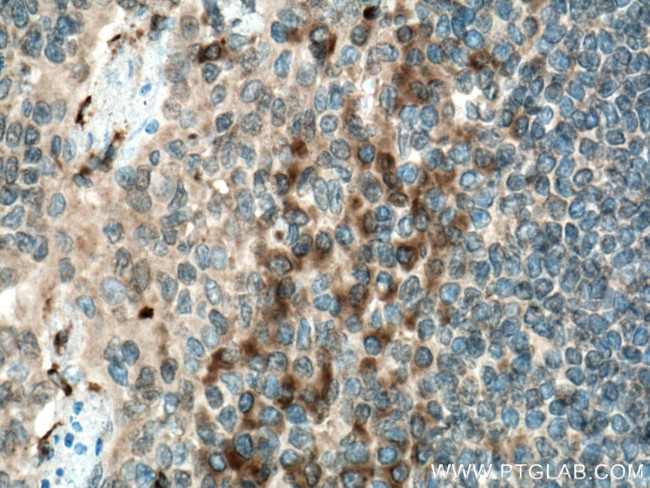 CD40L/CD154 Antibody in Immunohistochemistry (Paraffin) (IHC (P))