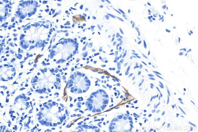 MAdCAM1 Antibody in Immunohistochemistry (Paraffin) (IHC (P))